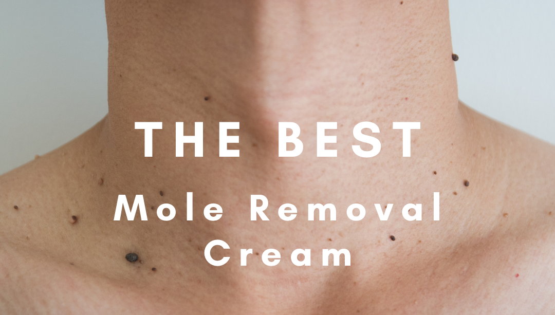 mole removal cost
